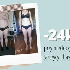Metamorfoza: -24kg przy niedoczynności tarczycy i hashimoto. Historia sukcesu, jak schudnąć przy niedoczynności tarczycy blog.
