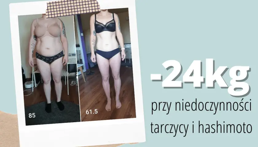 Metamorfoza: -24kg przy niedoczynności tarczycy i hashimoto. Historia sukcesu, jak schudnąć przy niedoczynności tarczycy blog.