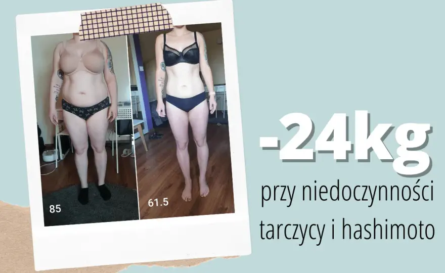 Odchudzanie z niedoczynnością tarczycy: Praktyczny przewodnik krok po kroku